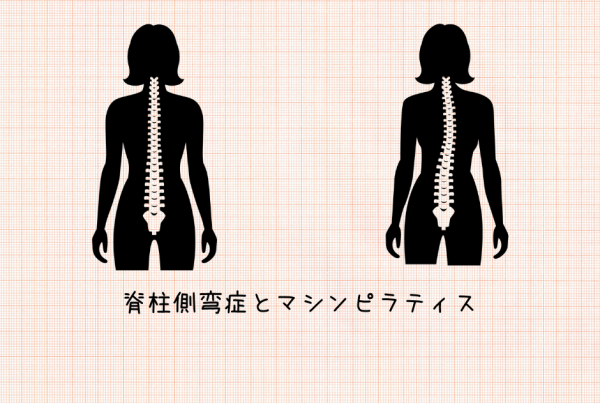 脊柱側弯症とマシンピラティス